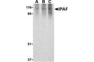 Western blot analysis of Ipaf in human PBL lysate with AP30437PU-N Ipaf antibody at 0. (NLRC4 Antikörper)