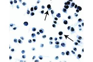 Immunohistochemical staining of MGMT. (MGMT Antikörper)