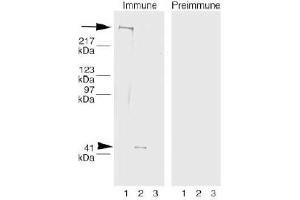 Image no. 1 for anti-Collagen, Type VII, alpha 1 (COL7A1) (AA 479-578), (AA 757-967), (AA 97-200) antibody (ABIN191494)