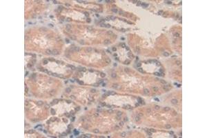 Used in DAB staining on fromalin fixed paraffin- embedded kidney tissue (MDH1 Antikörper  (AA 2-334))