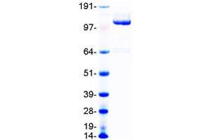 Validation with Western Blot