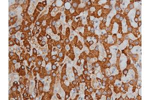 Immunohistochemistry (IHC) image for anti-Histone Deacetylase 3 (HDAC3) (pSer424) antibody (ABIN6256332)