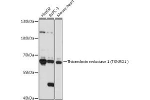 Western blot analysis of extracts of various cell lines, using Thioredoxin reductase 1 (Thioredoxin reductase 1 (TXNRD1 ) ) antibody (ABIN7270806) at 1:1000 dilution. (TXNRD1 Antikörper)