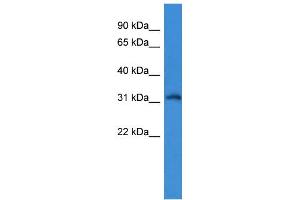 WB Suggested Anti-KCNIP4 Antibody Titration: 0.