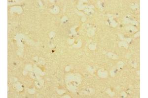 Immunohistochemistry of paraffin-embedded human brain tissue using ABIN7156544 at dilution of 1:100 (ICAM5 Antikörper  (AA 32-180))