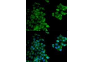 Immunofluorescence analysis of HeLa cells using PSMB10 antibody (ABIN6132527, ABIN6146311, ABIN6146312 and ABIN6221107).