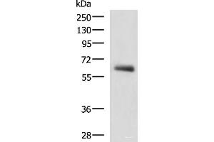 Western blot analysis of Human metastatic papillary carcinoma(thyroid cancer) tissue lysate using KBTBD11 Polyclonal Antibody at dilution of 1:2300 (KBTBD11 Antikörper)