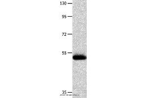 Western blot analysis of Human endometrial carcinoma tissue  , using MMP10 Polyclonal Antibody at dilution of 1:200 (MMP10 Antikörper)