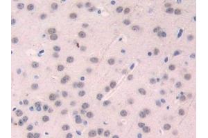 Immunohistochemistry (IHC) image for anti-Fucosyltransferase 4 (Alpha (1,3) Fucosyltransferase, Myeloid-Specific) (FUT4) (AA 144-389) antibody (ABIN7440164)