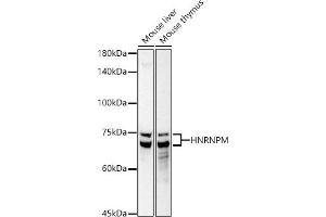 Western blot analysis of extracts of various cell lines, using HNRNPM antibody (ABIN7267635) at 1:1000 dilution. (HNRNPM Antikörper)