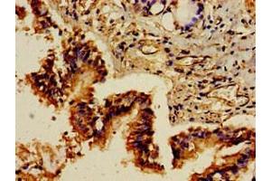 Immunohistochemistry of paraffin-embedded human lung tissue using ABIN7154494 at dilution of 1:100 (PIK3R1 Antikörper  (AA 15-180))