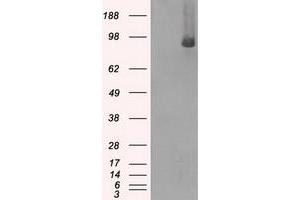 Western Blotting (WB) image for anti-B-Raf proto-oncogene, serine/threonine kinase (BRAF) antibody (ABIN1496953) (BRAF Antikörper)