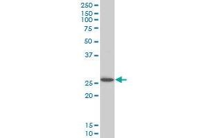 HOXC12 monoclonal antibody (M01), clone 1C6 Western Blot analysis of HOXC12 expression in Jurkat . (HOXC12 Antikörper  (AA 1-100))