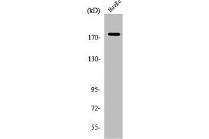 Western Blot analysis of HuvEc cells using ABCA8 Polyclonal Antibody (ABCA8 Antikörper  (Internal Region))