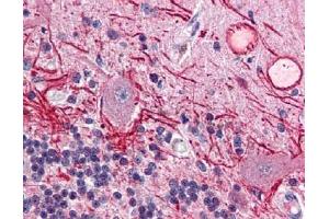 Immunohistochemistry (IHC) image for anti-V-Akt Murine Thymoma Viral Oncogene Homolog 1 (AKT1) (Thr308) antibody (ABIN400786) (AKT1 Antikörper  (Thr308))