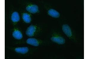 IF analysis of ZNRF3 using anti-ZNRF3 antibody (ABIN7602004).
