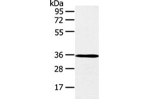 Western blot analysis of K562 cell and mouse brain tissue using E2F5 Polyclonal Antibody at dilution of 1:400 (E2F5 Antikörper)