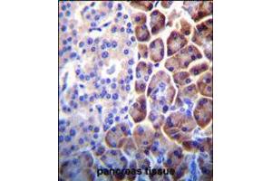 COPE Antibody immunohistochemistry analysis in formalin fixed and paraffin embedded human pancreas tissue followed by peroxidase conjugation of the secondary antibody and DAB staining. (COPE Antikörper  (C-Term))
