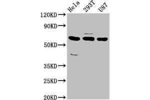 Western Blot Positive WB detected in: Hela whole cell lysate, 293T whole cell lysate, U87 whole cell lysate All lanes: NETO1 antibody at 3. (NETO1 Antikörper  (AA 367-507))