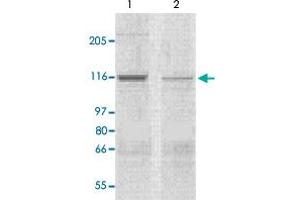 The tissue lysates derived from mouse heart (lane 1) or rat heart (lane 2) were immunoprobed by Corin polyclonal antibody  at 1 : 500. (Corin Antikörper  (N-Term))