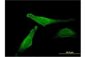 Immunofluorescence of monoclonal antibody to MB on HeLa cell. (Myoglobin Antikörper  (AA 2-100))