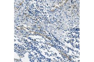 IHC analysis of CD31/PECAM1 using anti-CD31/PECAM1 antibody (ABIN7601076). (CD31 Antikörper  (AA 28-382))