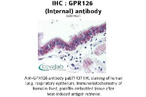 Image no. 2 for anti-G Protein-Coupled Receptor 126 (GPR126) (Internal Region) antibody (ABIN1734924) (G Protein-Coupled Receptor 126 Antikörper  (Internal Region))