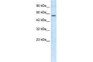 WB Suggested Anti-ETS1 Antibody Titration:  1. (ETS1 Antikörper  (N-Term))