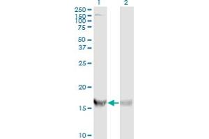Western Blot analysis of RPS19 expression in transfected 293T cell line by RPS19 monoclonal antibody (M01A), clone 3C6. (RPS19 Antikörper  (AA 1-145))