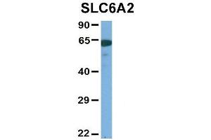 Host:  Rabbit  Target Name:  SLC6A2  Sample Type:  Human Adult Placenta  Antibody Dilution:  1. (SLC6A2 Antikörper  (Middle Region))
