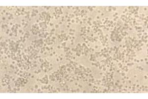 Activity Assay (AcA) image for Platelet/endothelial Cell Adhesion Molecule (PECAM1) (AA 28-601) (Active) protein (His tag) (ABIN7607344)