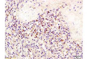 Formalin-fixed and paraffin embedded human spleen tissue labeled with Anti-SEMA4D/CD100 Polyclonal Antibody, Unconjugated (ABIN1387543) at 1:200 followed by conjugation to the secondary antibody and DAB staining (SEMA4D/CD100 Antikörper  (AA 75-170))