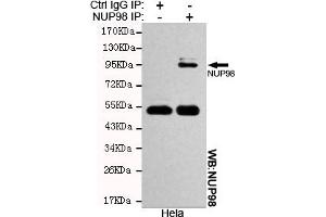 Immunoprecipitation analysis of Hela cell lysates using NUP98 mouse mAb. (NUP98 Antikörper)