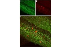 Expression of CB1 receptor in mouse hippocampusImmunohistochemical staining of mouse hippocampus using Anti-Cannabinoid Receptor 1 (extracellular) Antibody (ABIN7043023, ABIN7044155 and ABIN7044156), (1:100). (Cannabinoid Receptor 1 (CNR1) Peptid)
