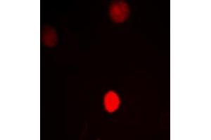 Immunofluorescent analysis of CTBP1 staining in HeLa cells. (CTBP1 Antikörper  (C-Term))