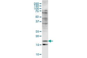 CFL2 monoclonal antibody (M03), clone 6G9 Western Blot analysis of CFL2 expression in HeLa . (Cofilin 2 Antikörper  (AA 57-166))