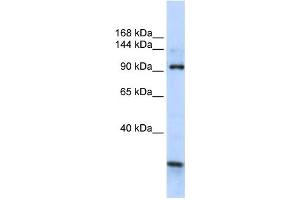 Western Blotting (WB) image for anti-KIAA1024 (KIAA1024) antibody (ABIN2459070) (KIAA1024 Antikörper)