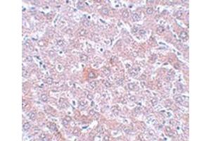 Immunohistochemical staining of rat liver tissue with RSRC1 polyclonal antibody  at 5 ug/mL dilution. (RSRC1 Antikörper  (C-Term))