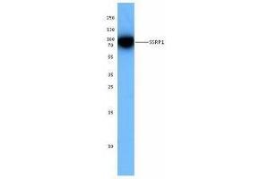 Western Blotting (WB) image for anti-Structure Specific Recognition Protein 1 (SSRP1) antibody (ABIN2666367) (SSRP1 Antikörper)