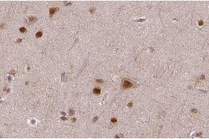 ABIN6272540 at 1/100 staining human brain tissue sections by IHC-P. (ASPM Antikörper  (Internal Region))