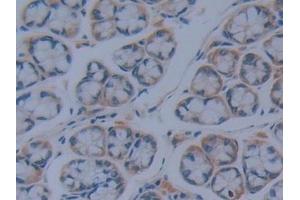 Detection of IkBd in Mouse Intestine Tissue using Polyclonal Antibody to Inhibitory Subunit Of NF Kappa B Delta (IkBd) (IkBd Antikörper  (AA 58-304))