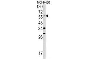 Western blot analysis of YAP1 antibody (C-term) in NCI-H460 cell line lysates (35ug/lane). (YAP1 Antikörper  (C-Term))