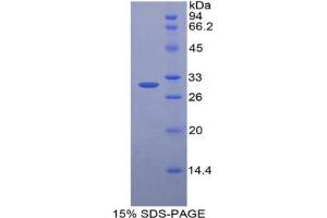 SDS-PAGE analysis of Mouse HGD Protein.