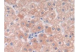 Detection of C9 in Human Liver Tissue using Polyclonal Antibody to Complement Component 9 (C9) (C9 Antikörper  (AA 22-265))