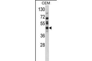 Western blot analysis of USP12 Antibody (N-term) (ABIN388898 and ABIN2839184) in CEM cell line lysates (35 μg/lane).