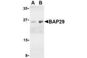 Western blot analysis of Bap29 in human heart tissue lysate with AP30121PU-N Bap29 antibody at (A) 1 and (B) 2 μg/ml. (BCAP29 Antikörper  (C-Term))