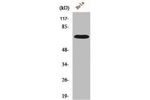 Western Blot analysis of HuvEc cells using IL-17RC Polyclonal Antibody (IL17RC Antikörper  (C-Term))