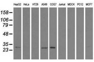 Image no. 2 for anti-Sepiapterin Reductase (SPR) antibody (ABIN1501116) (SPR Antikörper)
