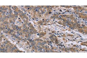 Immunohistochemistry (Paraffin-embedded Sections) (IHC (p)) image for anti-Gelsolin (GSN) antibody (ABIN7242173)