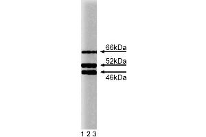Western blot analysis of SHC on a HeLa cell lysate (Human cervical epitheloid carcinoma, ATCC CCL-2. (SHC1 Antikörper  (AA 359-473))